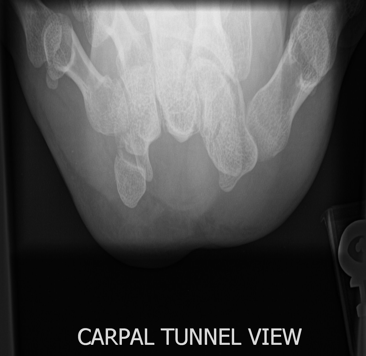 UCSD Musculoskeletal Radiology